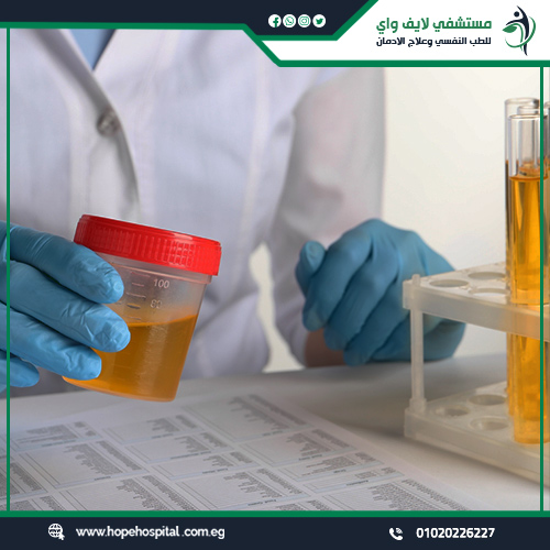 كم مدة بقاء الحشيش في البول؟